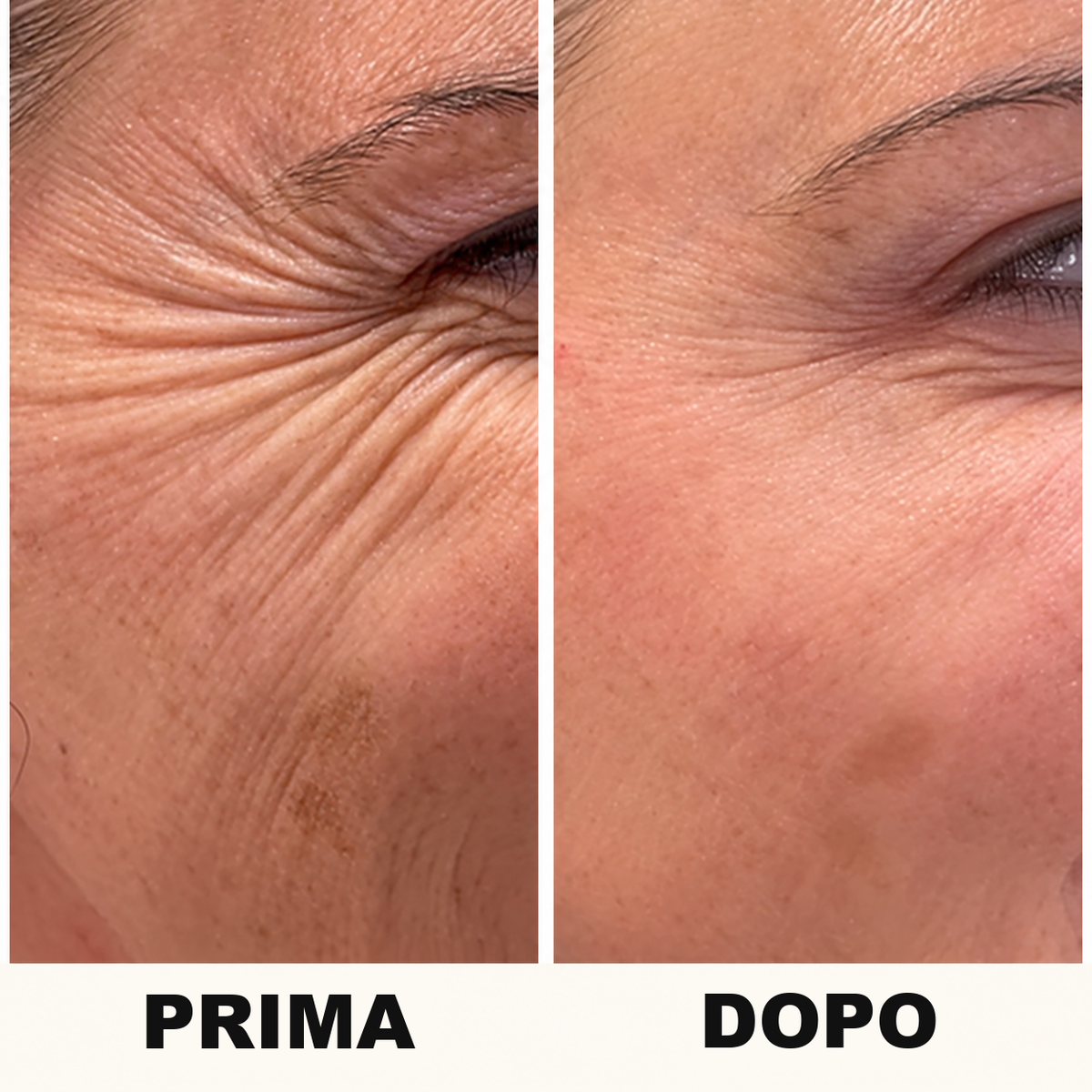 Peptidi Di Collagene Di Aureva Paris